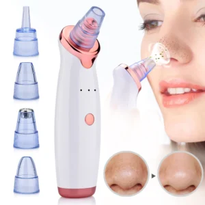 Electric Facial Acne Remover